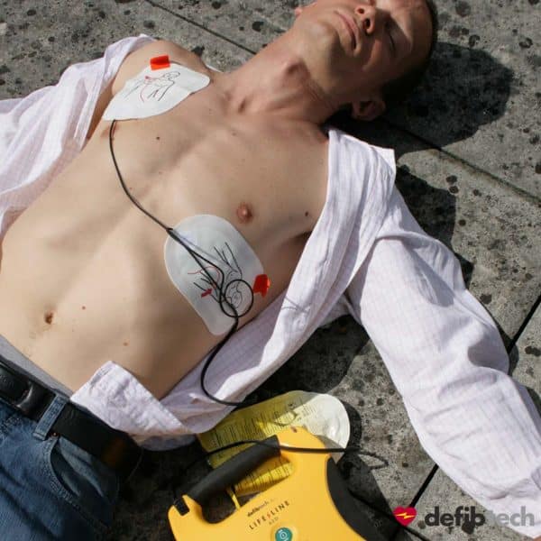 pose des électrodes de défibrillation sur un patient en arrêt cardiaque