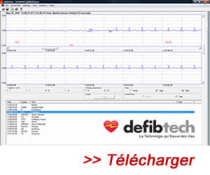 Photo du logiciel Defibview Defibtech